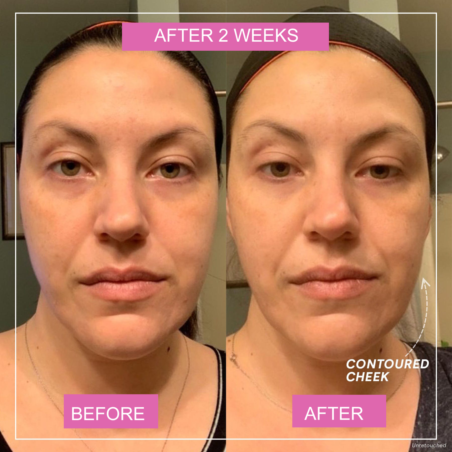 Skinful Glow® Jawline & Cheekbones Lift