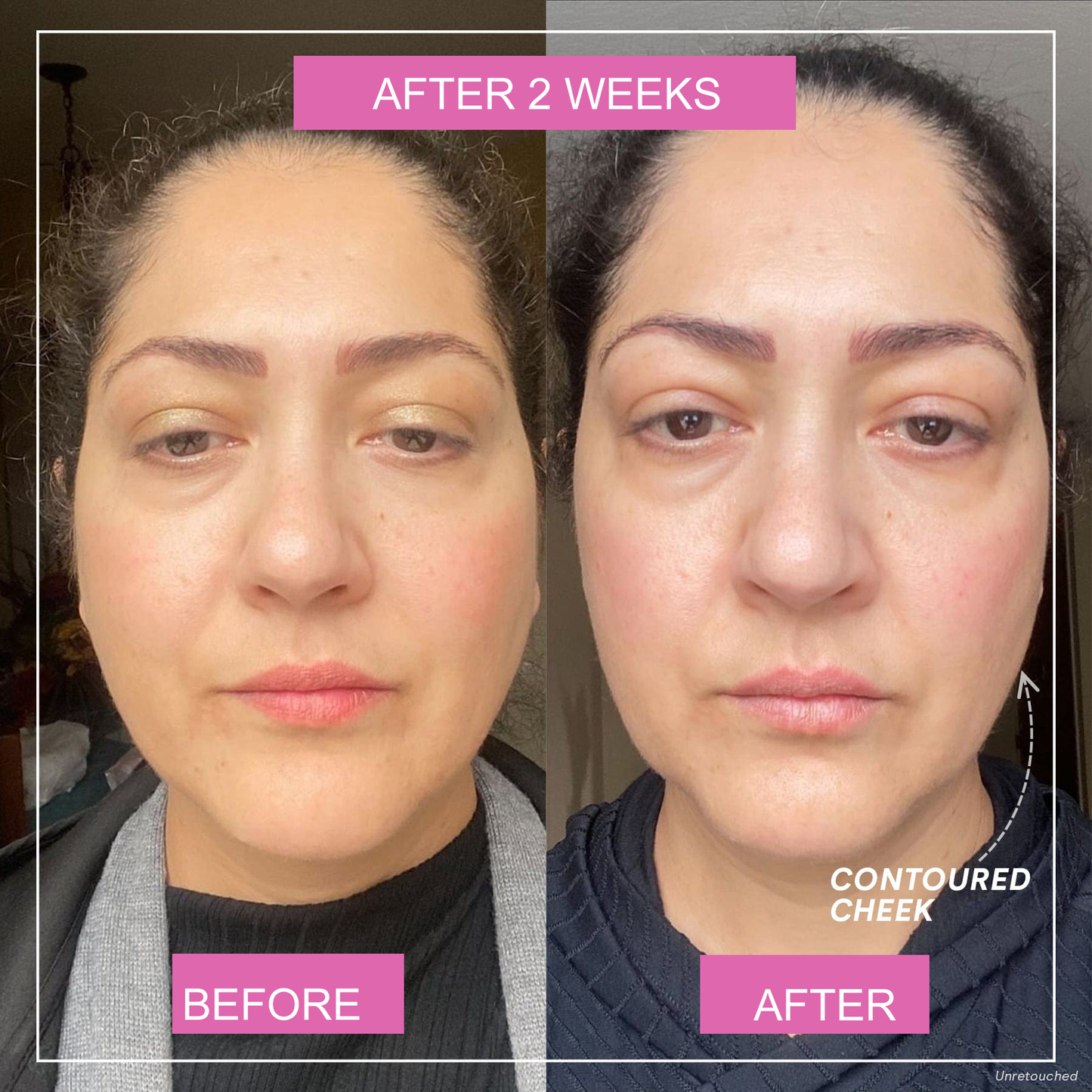 Skinful Glow® Jawline & Cheekbones Lift